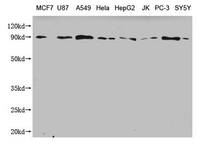 Western Blot Positive WB detected in: MCF7 whole cell lysate, U87 whole cell lysate, A549 whole cell lysate, Hela whole cell lysate, HepG2 whole cell lysate, JK whole cell lysate, PC-3 whole cell lysate, SY5Y whole cell lysate All lanes: CANX anti...