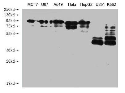 Western Blot Positive WB detected in: MCF7 whole cell lysate, U87 whole cell lysate, A549 whole cell lysate, Hela whole cell lysate, HepG2 whole cell lysate, U251 whole cell lysate, K562 whole cell lysate All lanes: CANX antibody at 1:2000 Seconda...