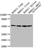 Western Blot Positive WB detected in: Rabbit lung tissue, Rabbit liver tissue, Rabbit spleen tissue, Rabbit small intestine tissue All lanes: CD14 antibody at 1:2500 Secondary Goat polyclonal to Mouse IgG at 1/10000 dilution Predicted band size: 4...