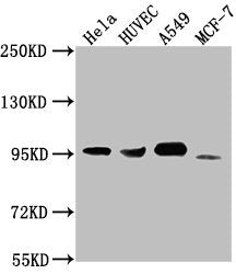 Western Blot Positive WB detected in: Hela whole cell lysate, HUVEC whole cell lysate, A549 whole cell lysate, MCF-7 whole cell lysate All lanes: CD44 antibody at 1:1500 Secondary Goat polyclonal to Mouse IgG at 1/10000 dilution Predicted band siz...