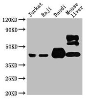 Western Blot Positive WB detected in: Jurkat whole cell lysate, Raji whole cell lysate, Daudi whole cell lysate, Mouse liver tissue All lanes: CD48 antibody at 1:4000 Secondary Goat polyclonal to mouse IgG at 1/50000 dilution Predicted band size:...