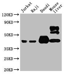 Western Blot Positive WB detected in: Jurkat whole cell lysate, Raji whole cell lysate, Daudi whole cell lysate, Mouse liver tissue All lanes: CD48 antibody at 1:4000 Secondary Goat polyclonal to mouse IgG at 1/50000 dilution Predicted band size:...