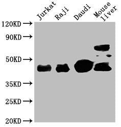 Western Blot Positive WB detected in: Jurkat whole cell lysate, Raji whole cell lysate, Daudi whole cell lysate, Mouse liver tissue All lanes: CD48 antibody at 1:2000 Secondary Goat polyclonal to mouse IgG at 1/50000 dilution Predicted band size:...