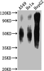 Western Blot Positive WB detected in: A549 whole cell lysate, Hela whole cell lysate, HepG2 whole cell lysate All lanes CD63 antibody at 1:1000 Secondary Goat polyclonal to mouse IgG at 1/50000 dilution Predicted band size: 30-120 KD KDa Observed...