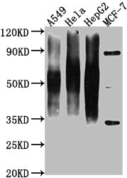 Western Blot Positive WB detected in: A549 whole cell lysate, Hela whole cell lysate, HepG2 whole cell lysate, MCF-7 whole cell lysate All lanes CD63 antibody at 1:1000 Secondary Goat polyclonal to mouse IgG at 1/50000 dilution Predicted band size...