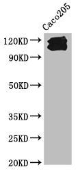 Western Blot Positive WB detected in: Caco205 whole cell lysate All lanes: CDH1 antibody at 1:1000 Secondary Goat polyclonal to Mouse IgG at 1/10000 dilution Predicted band size: 98, 91 kDa Observed band size: 110, 120 kDa