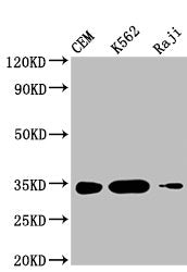Western Blot Positive WB detected in: CEM whole cell lysate, K562 whole cell lysate, Raji whole cell lysate All lanes: CTLA4 antibody at 1:1000 Secondary Goat polyclonal to mouse IgG at 1/50000 dilution Predicted band size: 25, 7, 9, 20 KDa Observ...