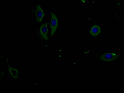 Immunofluorescence staining of A549 cells with CSB-MA007512PA981phHU at 1:100, counter-stained with DAPI. The cells were fixed in 4% formaldehyde and blocked in 10% normal Goat Serum. The cells were incubated with the antibody overnight at 4°C. Nu...