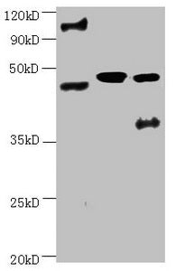 All lanes:Mouse anti-human ENO2 monoclonal antibody at 1ug/ml Lane 1:Hela cell lysate Lane 2:Recombinant Human Gamma-enolase(ENO2) at 10ug Lane 3:U251 cell lysate Secondary Goat polyclonal to Mouse IgG at 1/3000 dilution Predicted band size : 43,4...
