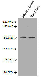 Western Blot Positive WB detected in: Mouse brain tissue, Rat brain tissue All lanes: GFAP antibody at 2.7µg/ml Secondary Goat polyclonal to Mouse IgG at 1/10000 dilution Predicted band size: 50, 51 kDa Observed band size: 50 kDa