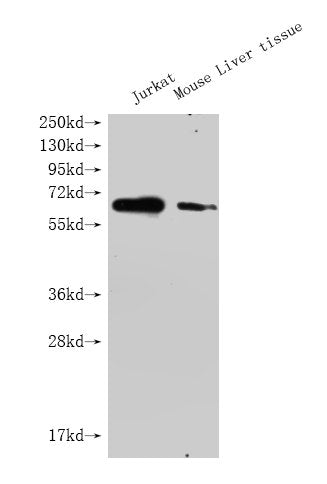 Western Blot Positive WB detected in: GPC3 antibody at 1:1000 Lane 1: Jurkat whole cell lysate Lane 2: Mouse liver tissue Secondary Goat polyclonal to Mouse IgG at 1/20000 dilution Predicted band size: 65-70KDa Observed band size: 65-70 KDa Exposu...