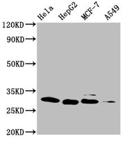 Western Blot Positive WB detected in: Hela whole cell lysate, HepG2 whole cell lysate, MCF-7 whole cell lysate, A549 whole cell lysate All lanes: GSTM3 antibody at 1:1000 Secondary Goat polyclonal to mouse IgG at 1/50000 dilution Predicted band si...