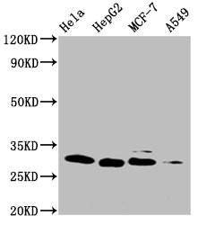 Western Blot Positive WB detected in: Hela whole cell lysate, HepG2 whole cell lysate, MCF-7 whole cell lysate, A549 whole cell lysate All lanes: GSTM3 antibody at 1:1000 Secondary Goat polyclonal to mouse IgG at 1/50000 dilution Predicted band si...