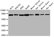 Western Blot Positive WB detected in: Hela whole cell lysate, NIH/3T3 whole cell lysate, K562 whole cell lysate, HepG2 whole cell lysate, Mouse spleen tissue, Rat spleen tissue, Mouse heart tissue, Rat heart tissue All lanes HSPA8 antibody at 1:20...