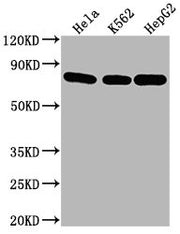 Western Blot Positive WB detected in: Hela whole cell lysate, K562 whole cell lysate, HepG2 whole cell lysate All lanes HSPA8 antibody at 1:2000 Secondary Goat polyclonal to mouse IgG at 1/50000 dilution Predicted band size: 70~75 KDa Observed ban...