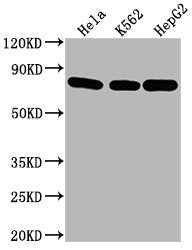 Western Blot Positive WB detected in: Hela whole cell lysate, K562 whole cell lysate, HepG2 whole cell lysate All lanes HSPA8 antibody at 1:2000 Secondary Goat polyclonal to mouse IgG at 1/50000 dilution Predicted band size: 70~75 KDa Observed ban...