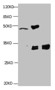 All lanes:Mouse anti-Human Cyfra21-1(KS19.1) monoclonal antibody at 4ug/ml Lane 1: MCF7 cell lysate Lane2: MDA-MB-231 cell lysate Lane3: HepG-2 cell lysate Secondary HRP labeled Goat polyclonal to Mouse IgG at 1/3000 dilution Predicted band size :...