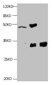 All lanes:Mouse anti-Human Cyfra21-1(KS19.1) monoclonal antibody at 4ug/ml Lane 1: MCF7 cell lysate Lane2: MDA-MB-231 cell lysate Lane3: HepG-2 cell lysate Secondary HRP labeled Goat polyclonal to Mouse IgG at 1/3000 dilution Predicted band size :...