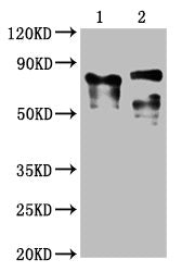 Western Blot Positive WB detected in: 1 lane: Recombinant proteins with LAG3; 2 lane: 293F whole cell lysate transfected with LAG3 All lanes: LAG3 antibody at 1:2000 Secondary Goat polyclonal to mouse IgG at 1/50000 dilution Predicted band size: 7...