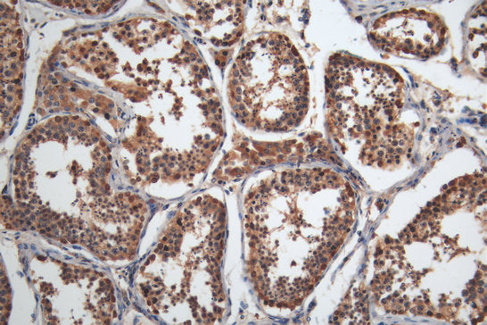 IHC image of CSB-MA013330A0m diluted at 1:200 and staining in paraffin-embedded human testis tissue performed on a Leica BondTM system. After dewaxing and hydration, antigen retrieval was mediated by high pressure in a citrate buffer (pH 6.0). Sec...