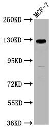 Western Blot Positive WB detected in: MCF-7 whole cell lysate All lanes: CD146 antibody at 1:1250 Secondary Goat polyclonal to Mouse IgG at 1/50000 dilution Predicted band size: 72, 58 kDa Observed band size: 120 kDa