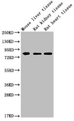 Western Blot Positive WB detected in: MMUT antibody at 1:1000 Lane 1: Mouse liver tissue Lane 2: Rat kidney tissue Lane 3: Rat heart tissue Secondary Goat polyclonal to Mouse IgG at 1/20000 dilution Predicted band size: 83 KDa Observed band size:...