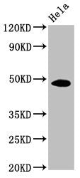 Western Blot Positive WB detected in: Hela whole cell lysate All lanes: MYC antibody at 1:500 Secondary Goat polyclonal to mouse IgG at 1/50000 dilution Predicted band size: 49, 51 KDa Observed band size: 49 KDa Exposure time：5min