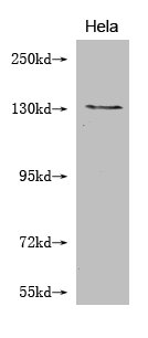 Western Blot Positive WB detected in: Hela whole cell lysate All lanes: NOS2 antibody at 1:2000 Secondary Goat polyclonal to mouse IgG at 1/50000 dilution Predicted band size: 131, 127 kDa Observed band size: 131 KDa Exposure time：5min