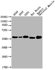 Western Blot Positive WB detected in: A549 whole cell lysate, 293T whole cell lysate, U251 whole cell lysate, Rat Brain tissue, Rabbit Skeletal Muscle tissue All lanes: PKM antibody at 1:1000 Secondary Goat polyclonal to Mouse IgG at 1/10000 dilut...