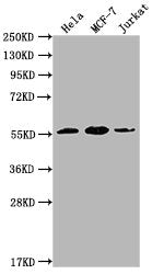 Western Blot Positive WB detected in: Hela whole cell lysate, MCF-7 whole cell lysate, Jurkat whole cell lysate All lanes: PKM antibody at 1:1000 Secondary Goat polyclonal to Mouse IgG at 1/10000 dilution Predicted band size: 58 kDa Observed band...