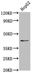 Western Blot Positive WB detected in: HepG2 whole cell lysate All lanes: OCT4 antibody at 1:500 Secondary Goat polyclonal to Mouse IgG at 1/10000 dilution Predicted band size: 39, 31 kDa Observed band size: 45 kDa
