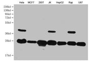 Western Blot Positive WB detected in: Hela whole cell lysate, MCF7 whole cell lysate, 293T whole cell lysate, JK whole cell lysate, HepG2 whole cell lysate, Raji whole cell lysate, U87 whole cell lysate All lanes: PRDX3 antibody at 1:1000 Secondar...
