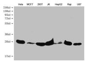 Western Blot Positive WB detected in: Hela whole cell lysate, MCF7 whole cell lysate, 293T whole cell lysate, JK whole cell lysate, HepG2 whole cell lysate, Raji whole cell lysate, U87 whole cell lysate All lanes: PRDX3 antibody at 1:1000 Secondar...