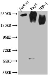 Western Blot