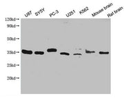 Western Blot Positive WB detected in: U87 whole cell lysate, SY5Y whole cell lysate, PC-3 whole cell lysate, U251 whole cell lysate, K562 whole cell lysate, Mouse brain tissue, Rat brain tissue All lanes: SDCBP antibody at 1:2000 Secondary Goat po...