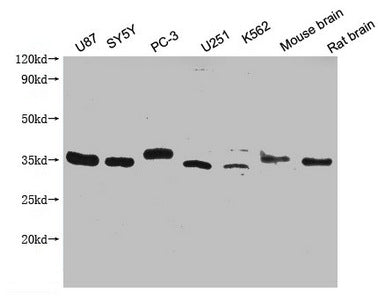 Western Blot Positive WB detected in: U87 whole cell lysate, SY5Y whole cell lysate, PC-3 whole cell lysate, U251 whole cell lysate, K562 whole cell lysate, Mouse brain tissue, Rat brain tissue All lanes: SDCBP antibody at 1:2000 Secondary Goat po...