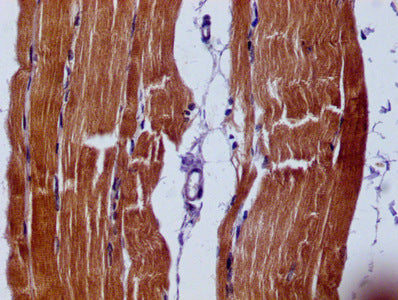 IHC image of CSB-MA021780A0m diluted at 1:60 and staining in paraffin-embedded human skeletal muscle tissue performed on a Leica BondTM system. After dewaxing and hydration, antigen retrieval was mediated by high pressure in a citrate buffer (pH 6...