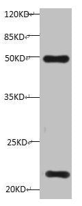 All lanes:Mouse anti-Human Timp1 monoclonal antibody at 1ug/ml Lane 1: HepG-2 cell lysate Predicted band size : 23 kDa Observed band size : 23 kDa Additional bands at:50KD