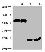 Western Blot Positive WB detected in: 1-2 lanes: 293F whole cell lysate transfected with BCMA; 3-4 lane: Recombinant proteins with BCMA All lanes: TNFRSF17 antibody at 1:1000 Secondary Goat polyclonal to mouse IgG at 1/50000 dilution Predicted ban...