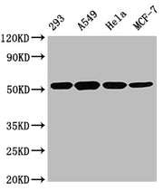 Western Blot Positive WB detected in: 293 whole cell lysate, A549 whole cell lysate, Hela whole cell lysate, MCF-7 whole cell lysate All lanes TUBB antibody at 1:5000 Secondary Goat polyclonal to mouse IgG at 1/50000 dilution Predicted band size:...