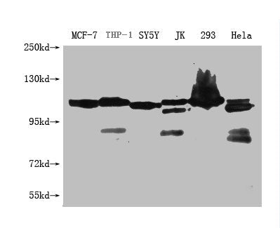 Western Blot Positive WB detected in: USP6 antibody at 1:1000 Lane 1: MCF-7 whole cell lysate Lane 2: THP-1 whole cell lysate Lane 3: SH-SY5Y whole cell lysate Lane 4: Jurkat whole cell lysate Lane 5: HEK293 whole cell lysate Lane 6: Hela whole ce...