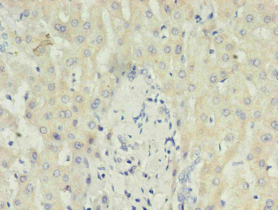 Immunohistochemistry of paraffin-embedded human liver using CSB-MA027411E0m in 30ug/ml dilute concentrations.