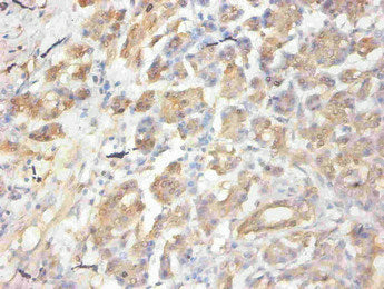 Immunohistochemical of paraffin-embedded human pancreas using CSB-MA058641A0m at dilution of 1:50
