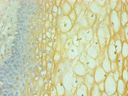 Immunohistochemical of paraffin-embedded human cervical using CSB-MA065241A0m at dilution of 1:200