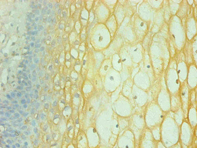 Immunohistochemical of paraffin-embedded human cervical using CSB-MA065241A0m at dilution of 1:200