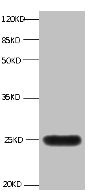 All lanes:Mouse anti-human Neutrophil gelatinase-associated lipocalin monoclonal antibody at 1ug/ml Lane 1:NGAL transfected 293 cell lysate Predicted band size : 22 kDa Observed band size : 25 kDa