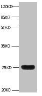 All lanes:Mouse anti-human Neutrophil gelatinase-associated lipocalin monoclonal antibody at 1ug/ml Lane 1:NGAL transfected 293 cell lysate Predicted band size : 22 kDa Observed band size : 25 kDa