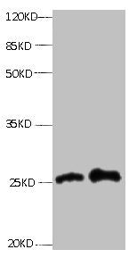 All lanes: Mouse anti- human Retinol-binding protein 4 monoclonal antibody at 0.3ug/ml Lane 1: Human positive serum1:10 Lane 2: Human positive serum1:100 Secondary:HRP labeled Goat polyclonal to Mouse IgG at 1/3000 dilution Predicted band size : 2...