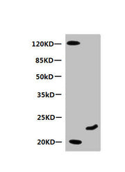 Western Blot All lanes: Mouse anti-Human Myoglobin monoclonal antibody at 0.3µg/ml Lane 1: Mouse heart muscle lysate Lane 2: Recombinant Myoglobin at 10µg Secondary HRP labeled Goat polyclonal to Mouse IgG at 1/3000 dilution Predicted band size: 1...