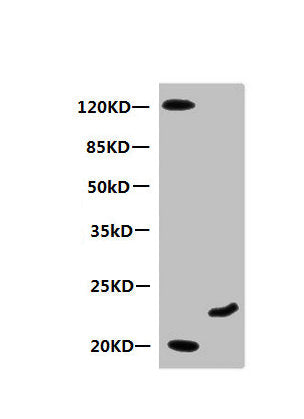 Western Blot All lanes: Mouse anti-Human Myoglobin monoclonal antibody at 0.3µg/ml Lane 1: Mouse heart muscle lysate Lane 2: Recombinant Myoglobin at 10µg Secondary HRP labeled Goat polyclonal to Mouse IgG at 1/3000 dilution Predicted band size: 1...